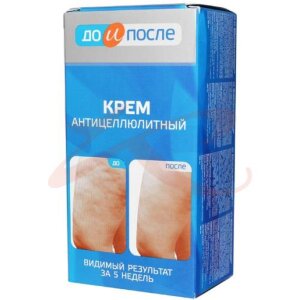 До и после крем а/целлюлит. 100мл. /твинс тэк/. Фото