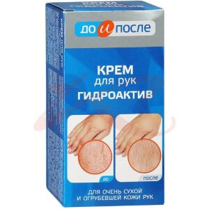 Изображение До и после крем для рук 100мл гидроактив До и после крем для рук 100мл гидроактив. Фото